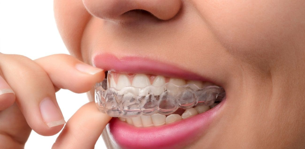 Invisalign Agoura Hills